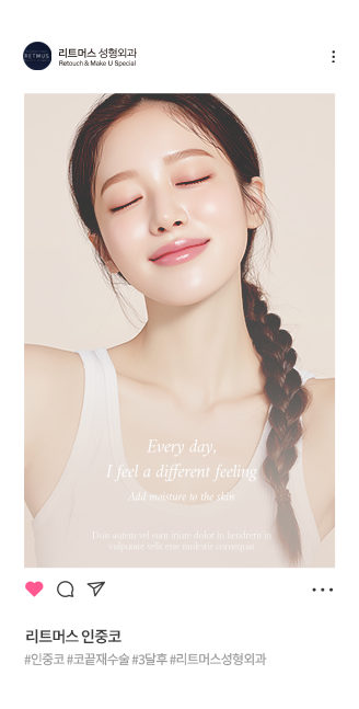 리트머스성형외과 안면윤곽 전후사진 이미지