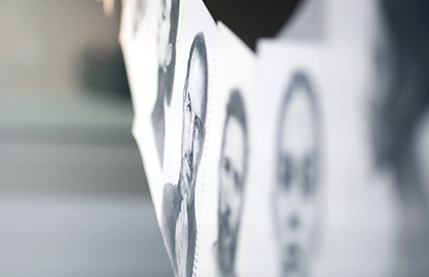 리트머스성형외과 차별화포인트 두번째 이미지