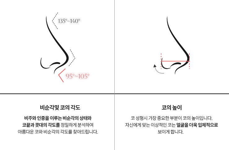 리트머스성형외과 콧날개올리기 이미지