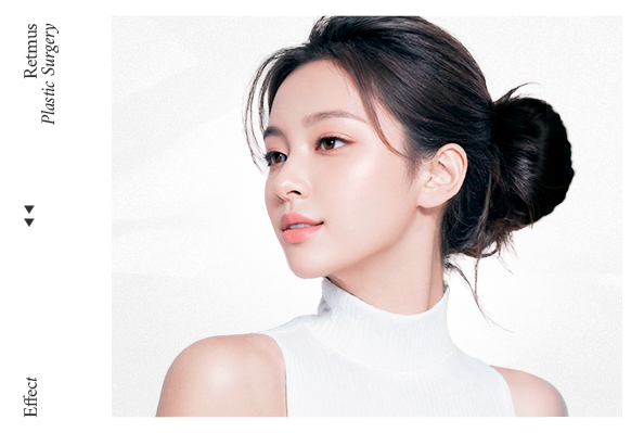 리트머스성형외과 콧날개올리기 모델 이미지