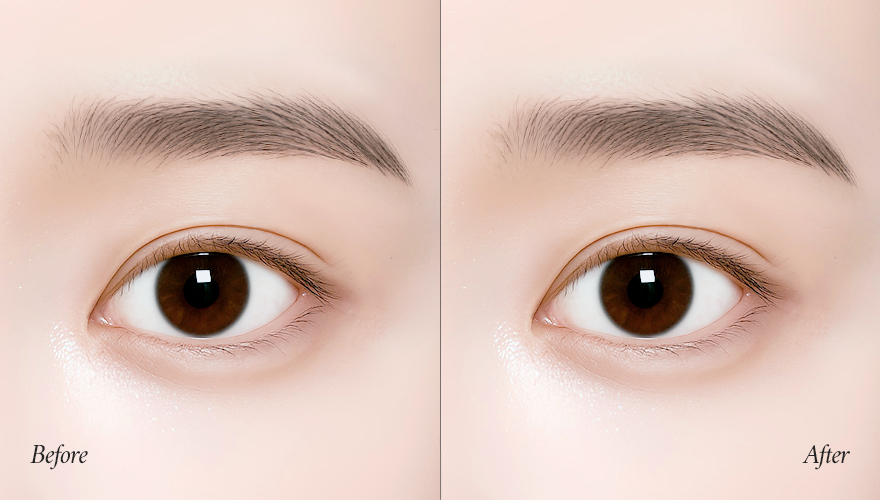 전후사진 테스트 이미지-삭제예정