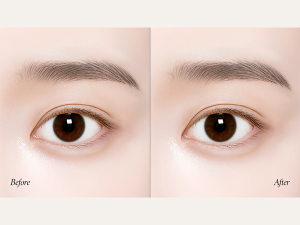 전후사진 썸네일 테스트 이미지-삭제예정