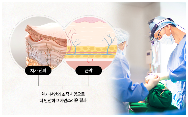 리트머스 자가진피 특별함 이미지