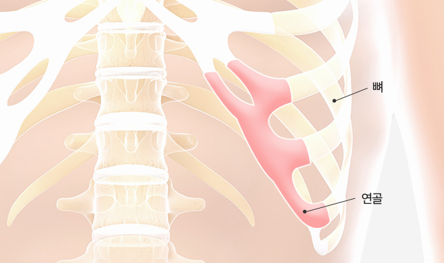 리트머스 성형외과 자가연골 설명 이미지