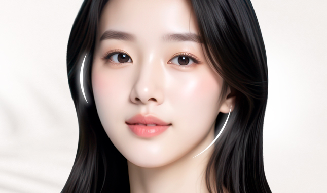 리트머스성형외과 광대 설명 이미지