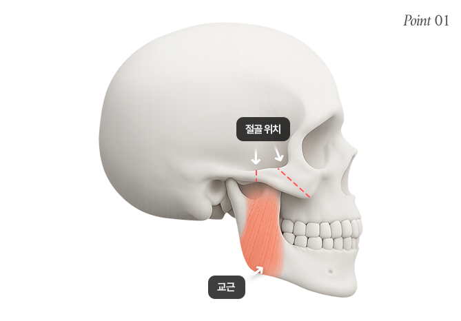 리트머스성형외과 광대뼈 단단하게 고정해야하는 이유 이미지