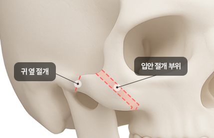 리트머스성형외과 차별화포인트 두번째 이미지
