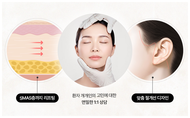 리트머스 안면거상의 특별함 이미지