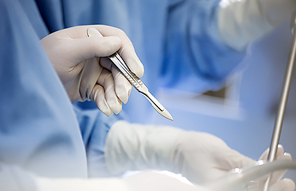 리트머스성형외과 미니거상 차별화 포인트 이미지