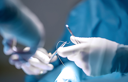 리트머스성형외과 미니거상 차별화 포인트 이미지