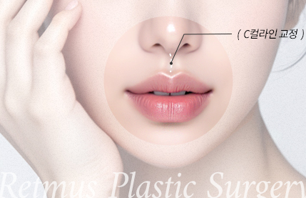 리트머스성형외과 차별화포인트 세번째 이미지