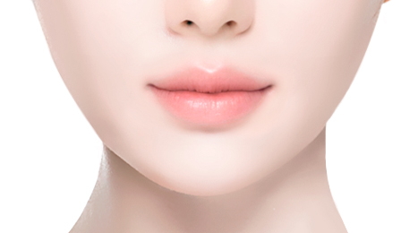 리트머스 외측입꼬리 수술방법 이미지