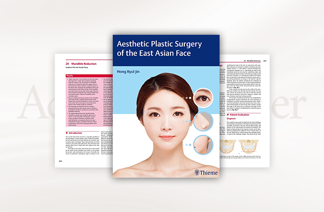 리트머스성형외과 안면윤곽수술 논문 이미지