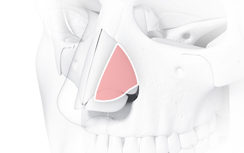 리트머스 비중격연골 이미지