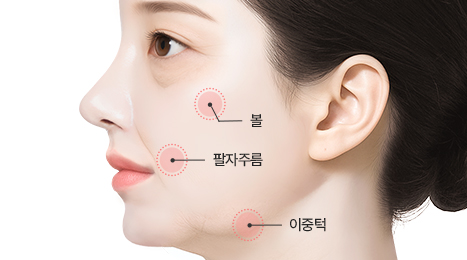 리트머스성형외과 미니거상 수술방법 이미지